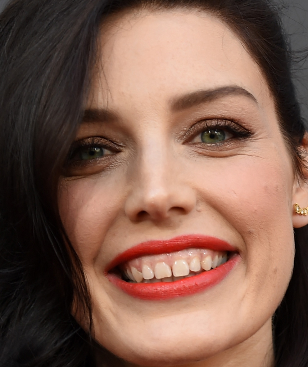See Rachel Weisz, Tom Cruise and More Stars Who Have Imperfect Smiles