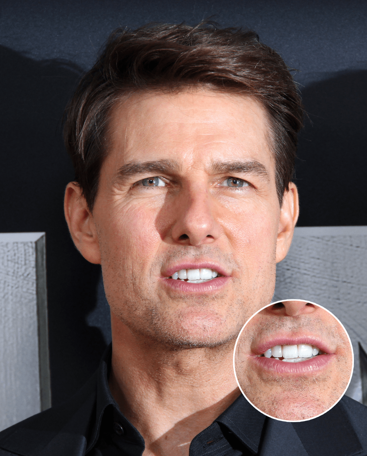 tom cruise has one front tooth