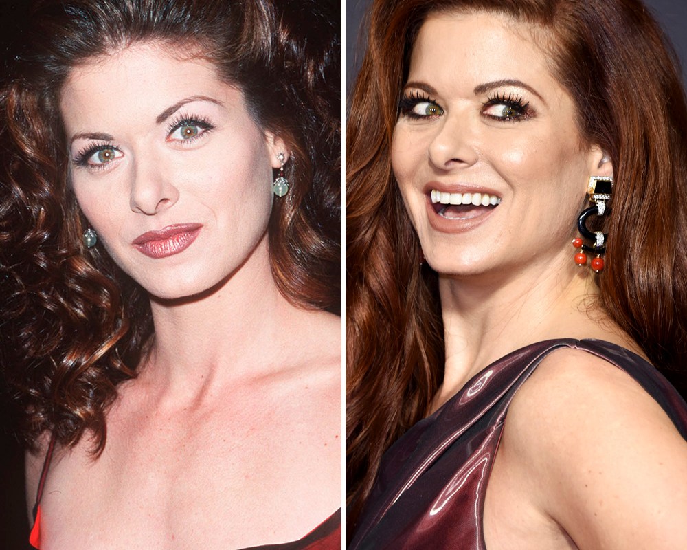 Debra Messing Plastic Surgery Before And After Celebr