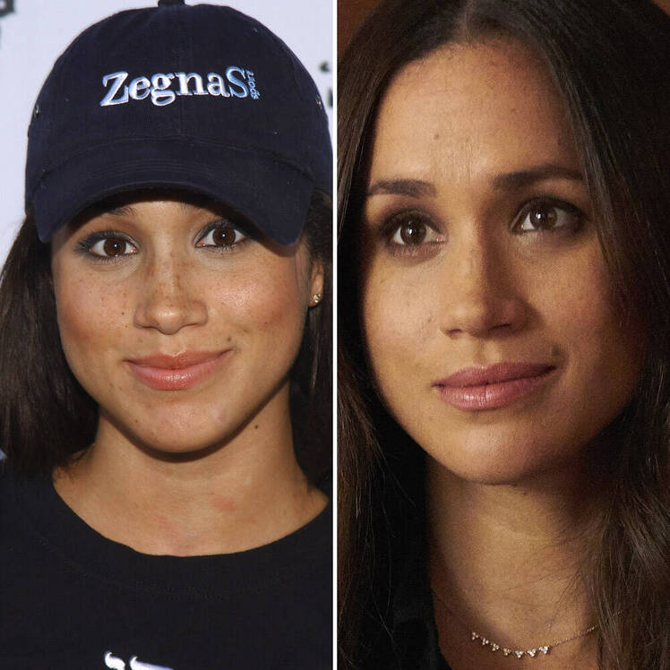meghan markle nose job getty images meghan markle nose job getty images