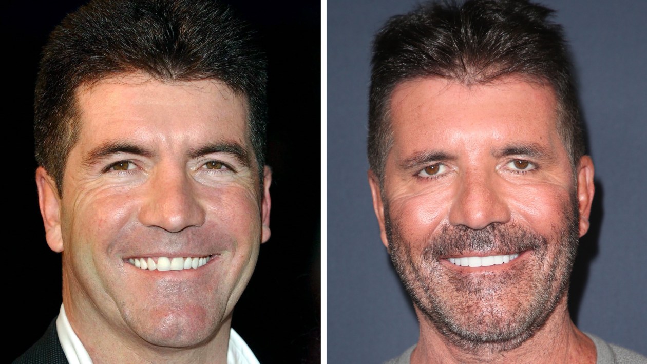 Simon Cowell Transformation See the 'X Factor' Judge Over the Years