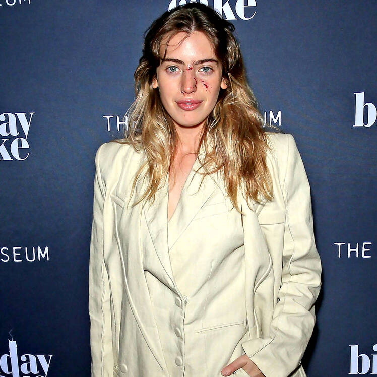 Ewan McGregors Daughter Clara Walks Red Carpet Hours After Dog Viciously Mauls Her Face