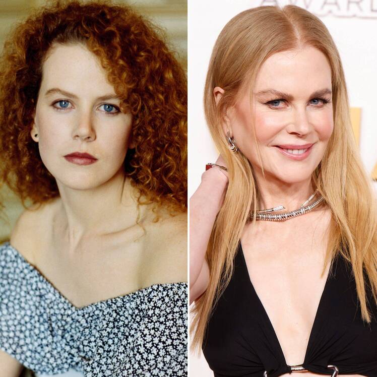 Nicole Kidman Addressed Plastic Surgery Rumors: Photos