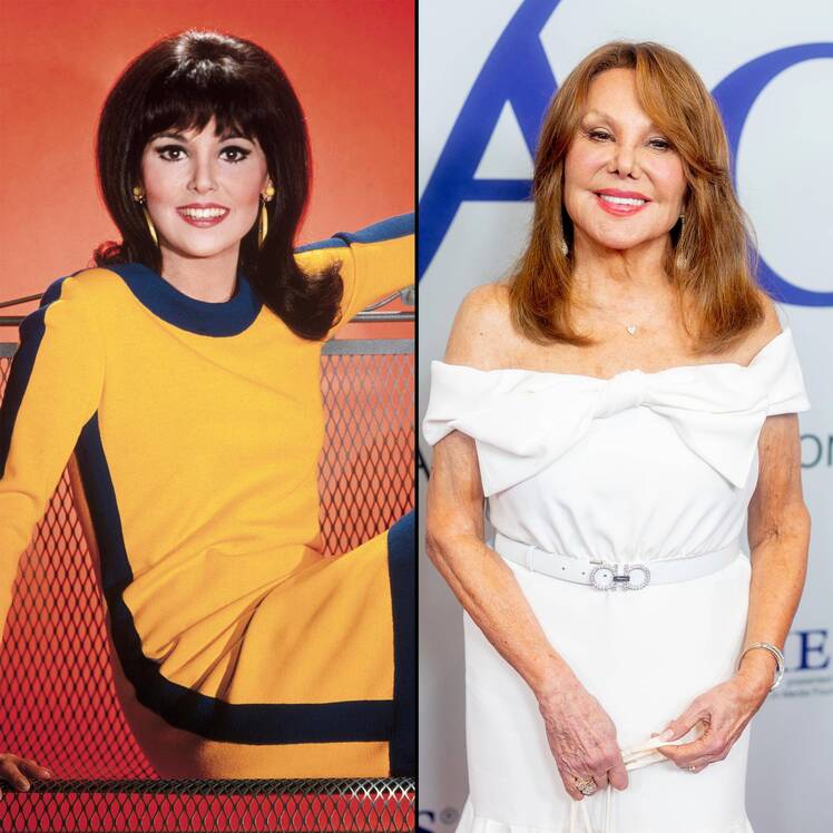 Marlo Thomas Plastic Surgery 893