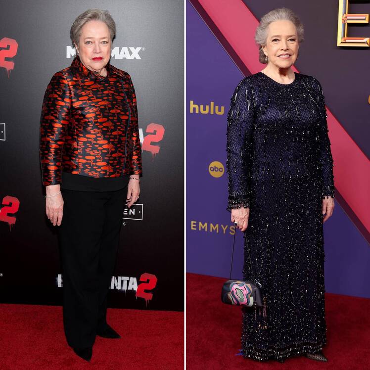 Kathy Bates Weight Loss Photos Before and After Pictures of the Actress